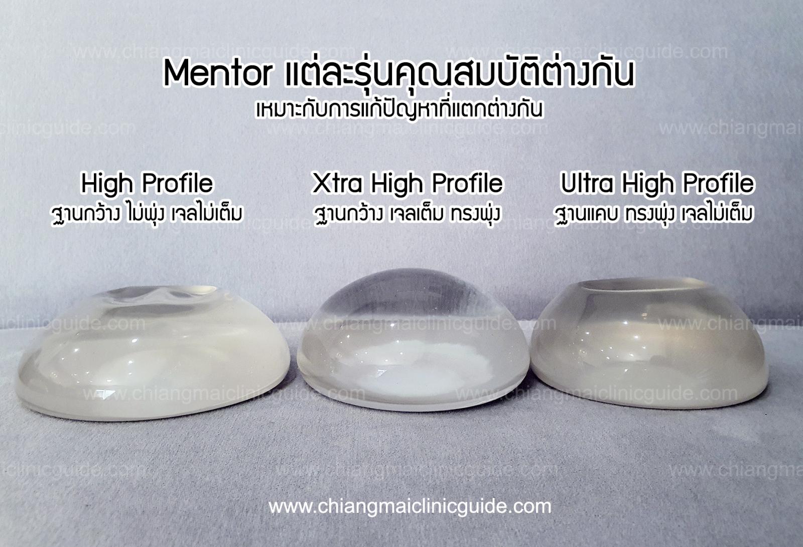 เปรียบเทียบซิลิโคนเสริมหน้าอก Mentor Memory Gel Xtra Ultra High Profile