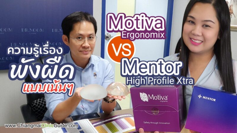ซิลิโคน Motiva Ergonomix กับ Mentor Xtra Gel รีวิวแตกต่างกันอย่างไร