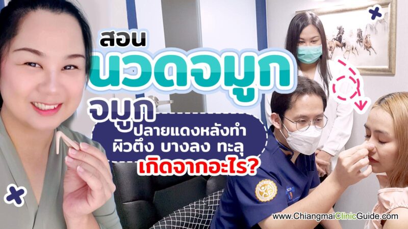 วิธีนวดจมูกหลังเสริมทำจมูก นวดสลายพังผืดจมูกได้ไหม ปลายจมูกแดง สันจมูกตึง เกิดจากอะไร