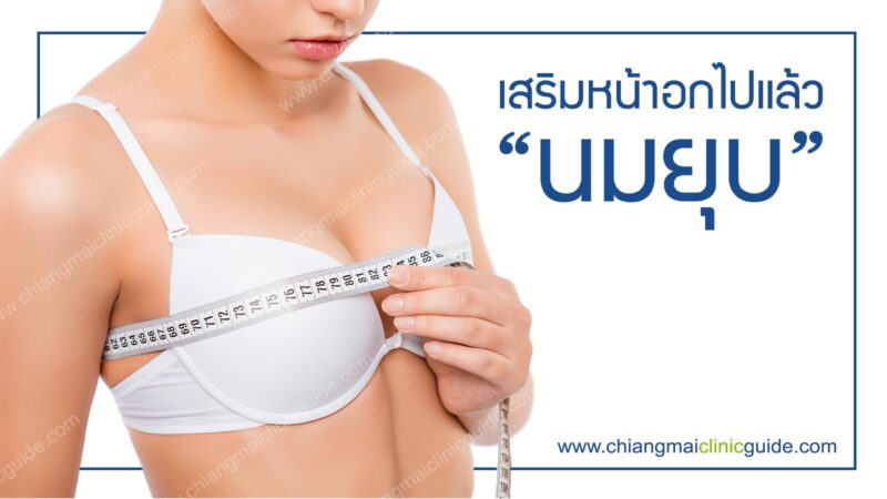 นมยุบหลังศัลยกรรมเสริมหน้าอก ปัญหาหลังเสริมอกจากการเลือกขนาดซิลิโคน