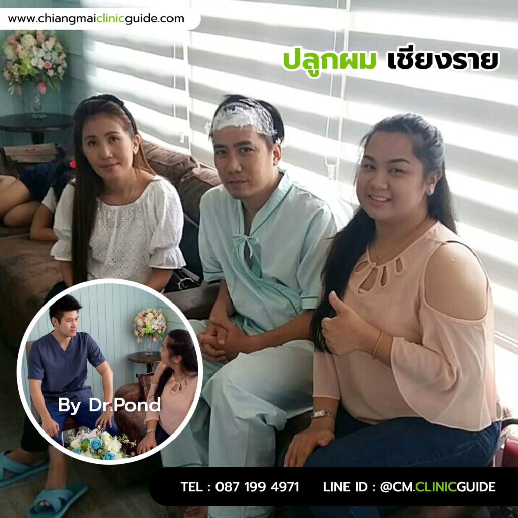 ปลูกผมเชียงราย โดยหมอปอนด์