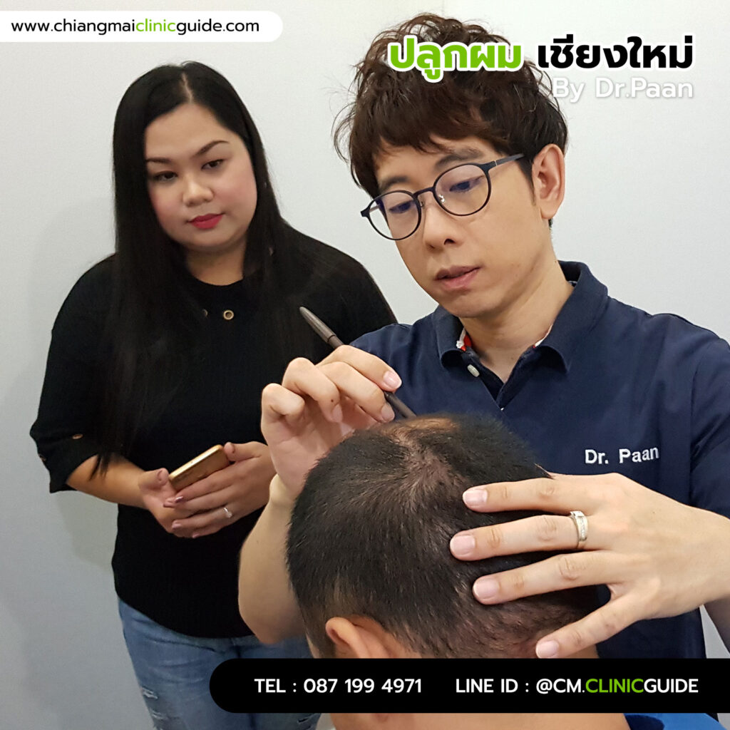 ปลูกผมเชียงใหม่ โดยหมอป่าน