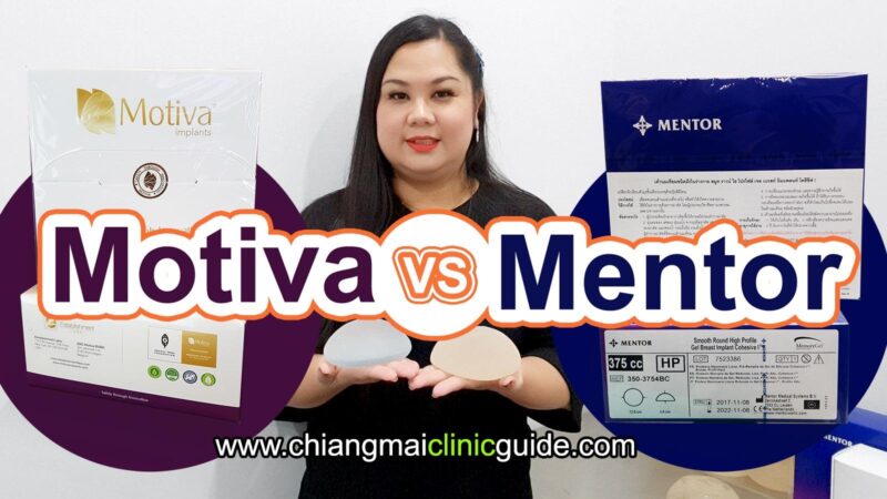 เปรียบเทียบซิลิโคนเสริมหน้าอกโมติว่า (Motiva) กับเมนเทอร์ (Mentor) ต่างกันยังไง