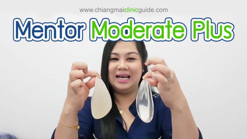 แนะนำ Mentor Moderate Plus รีวิวซิลิโคนเสริมหน้าอกอีกหนึ่งรุ่นของเมนเทอร์
