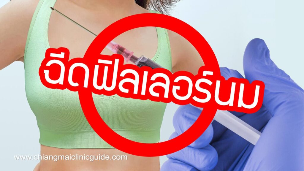 การฉีดฟิลเลอร์เสริมหน้าอก