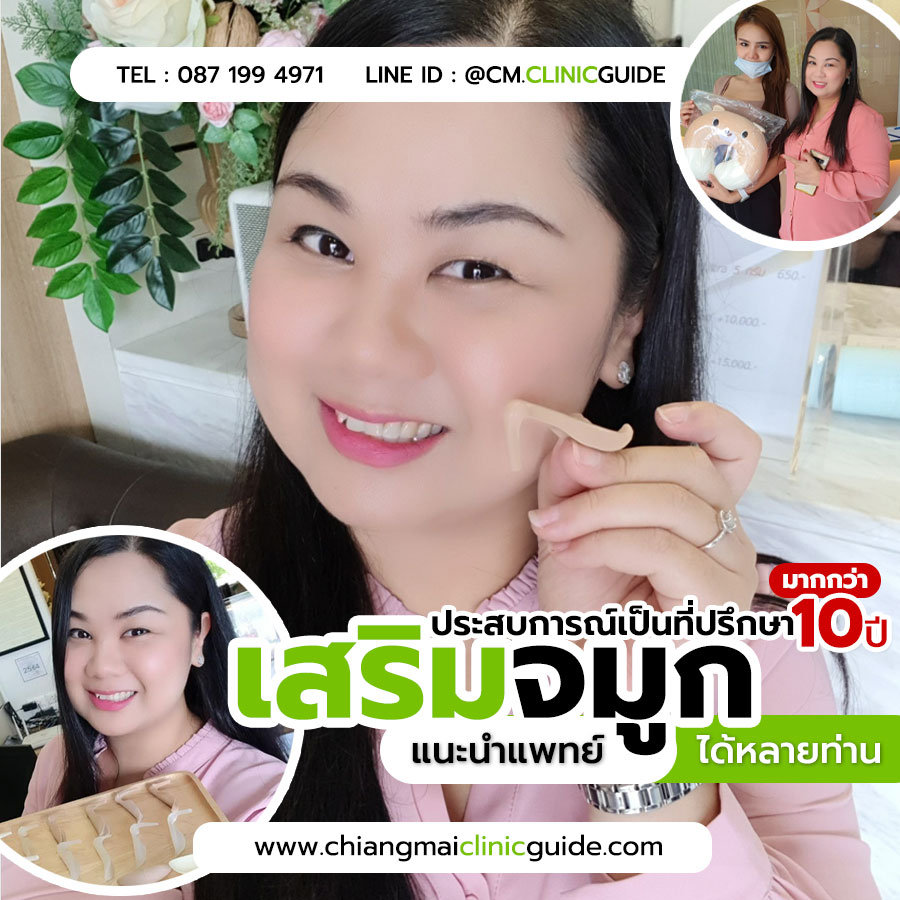 ศัลยกรรมเสริมจมูก ตัดปีกจมูก แก้ไขทำจมูก เชียงใหม่ เชียงราย ลำปาง แพร่ น่าน