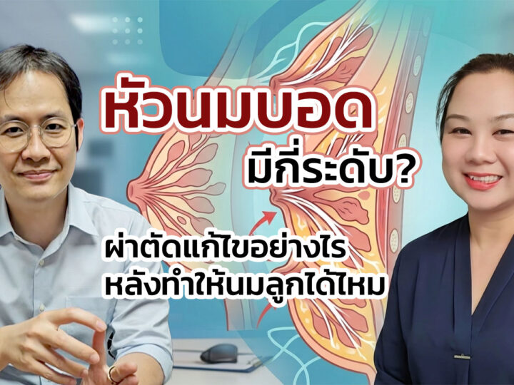 หัวนมบอด บุ๋ม มีกี่ระดับ? ผ่าตัดแก้ไขอย่างไร หลังทำให้นมลูกได้ไหม