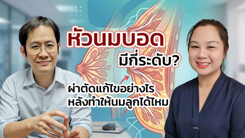 หัวนมบอด บุ๋ม มีกี่ระดับ? ผ่าตัดแก้ไขอย่างไร หลังทำให้นมลูกได้ไหม